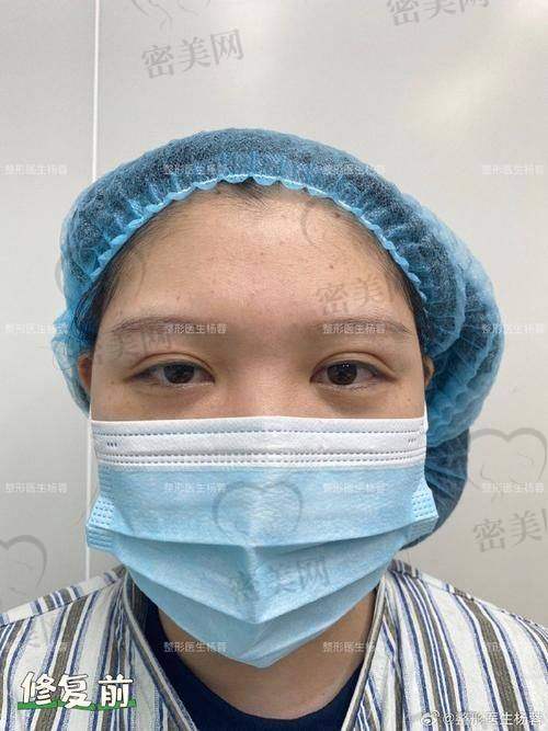 北京华韩谢立宁小鹿眼综合：口碑爆棚