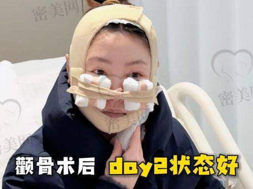 北京华韩吴国平颧骨内推：优势特色大揭秘