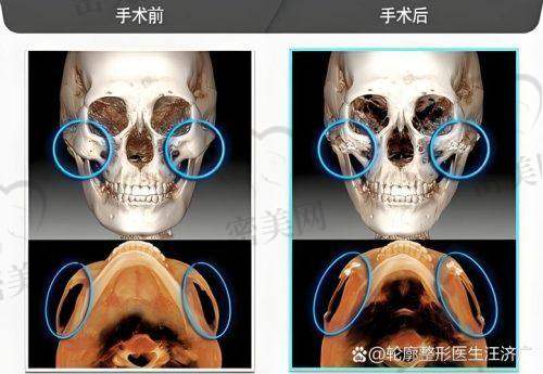 揭秘北京华韩吴国平医生：变得更美背后的神奇之手