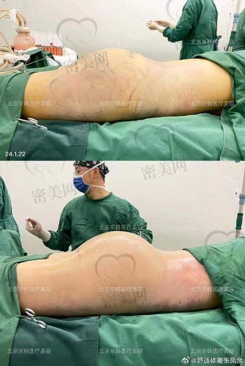 深圳曹孟君医疗美容门诊部