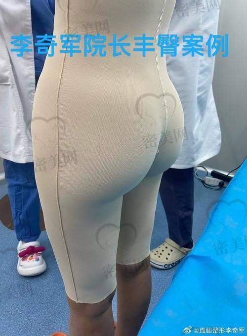 厦门荟美天成医疗美容（金贵香医生）