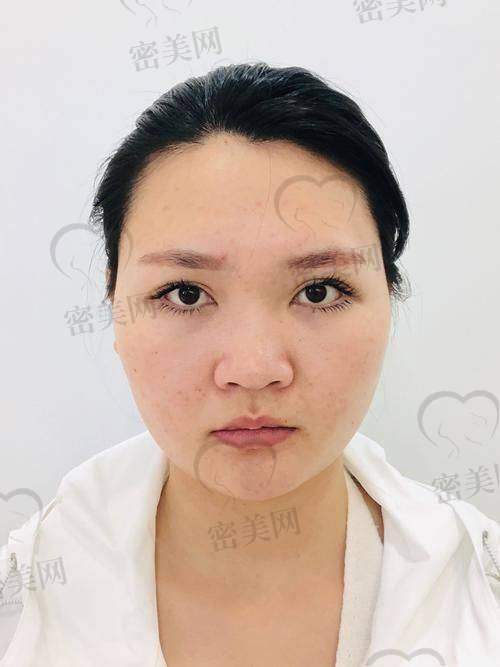 北京米兰柏羽丽都整形医院高海燕：亲民价格开启面部焕新之旅