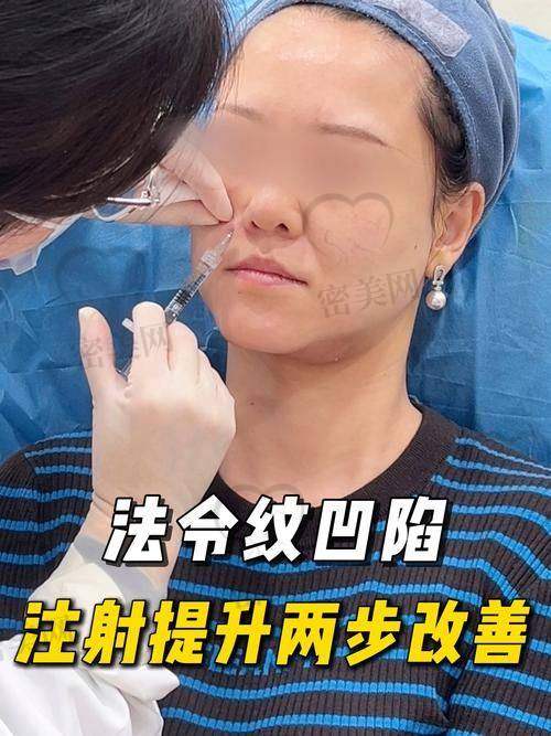 去除抬头纹，重拾青春光彩