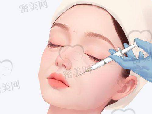法令纹填充前要注意啥？