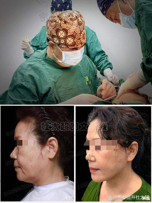 北京穆宝安拉皮和李晓东谁经验更丰富之医生信息大揭秘
