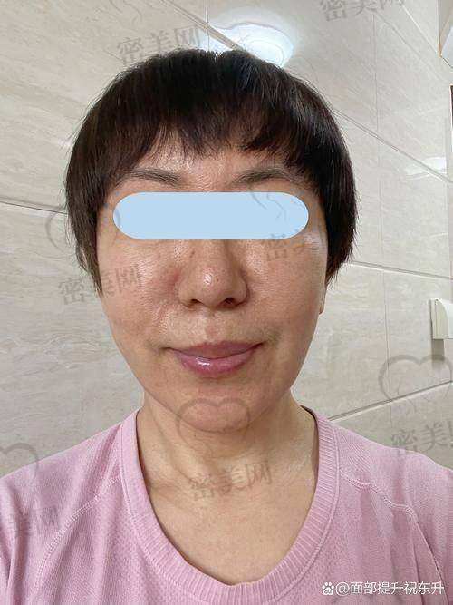 北京穆宝安拉皮和李晓东谁经验更丰富之技术优势对比