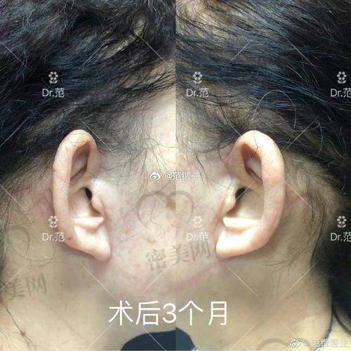 北京黄寺整形医院：精细控的最爱！