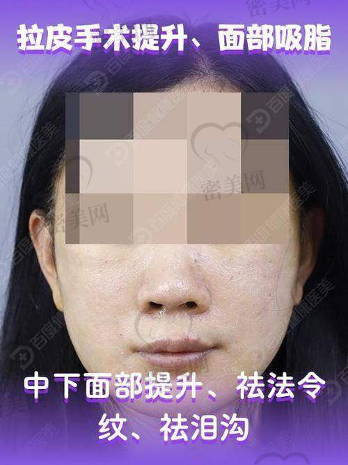 经典实例大曝光，成效看得见