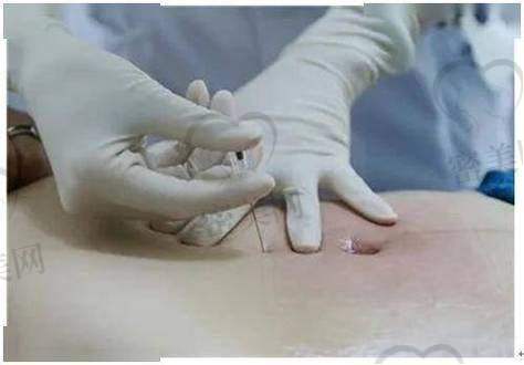 北京华韩整形医院虞守辉3S美学线提升：真人实例大震撼！