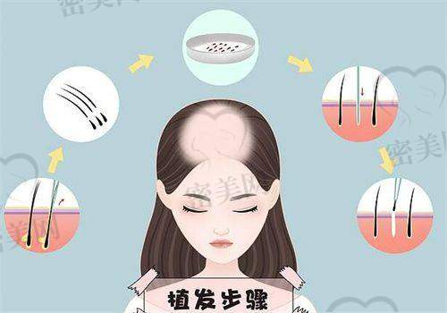 万州华美整形植发科：美学与技术的双重保护
