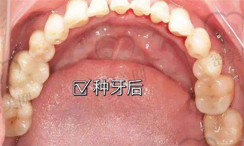 沈阳牙元素口腔医院有哪些分院？分布在哪些区域？