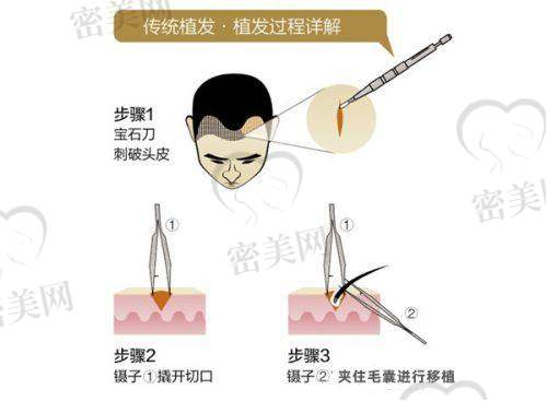 重庆时光植发中 心