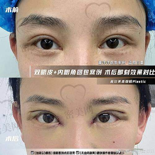 术后修复攻略，谁的“秘籍”更实用？