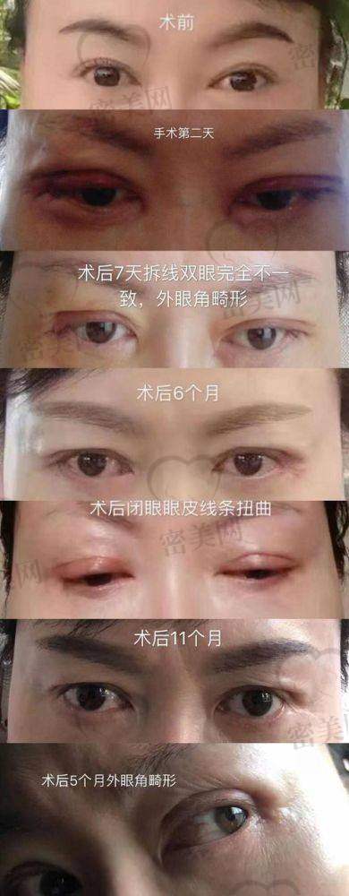佀同帅简介：档次初窥探