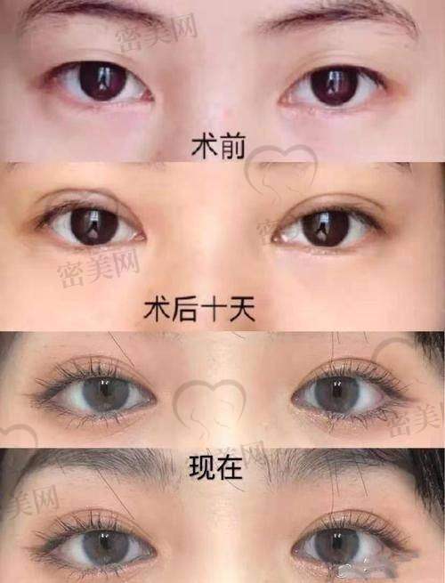 成都菲尔医疗美容门诊部 - 刘堃医生