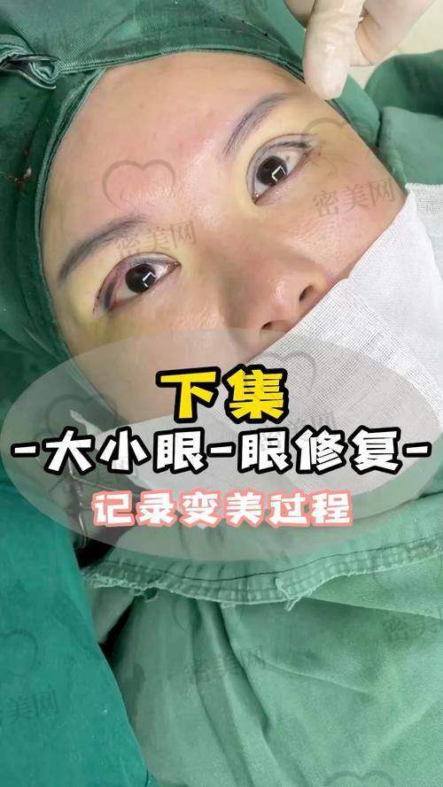 佀同帅双眼皮避雷是假的，技术优势超厉害