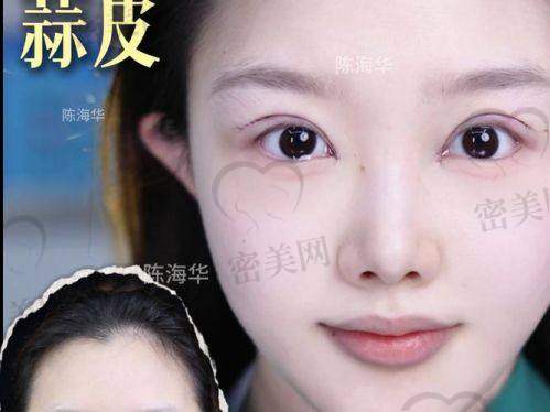 佀同帅双眼皮避雷是假的，专精能力杠杠滴