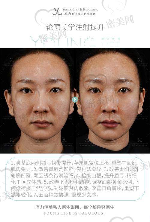 北京华韩整形医院虞守辉皇冠线打造：优势特色大揭秘