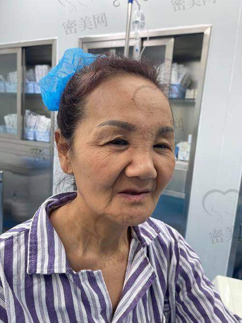 专精能力大考验，李志海医生实力究竟如何？