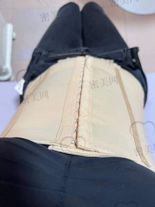 哪些人特别适合王欣医生这种“审美+技术”型保守吸脂？