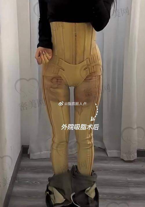 成都艾米丽整形美容：术后管理贴心，重视精益求精