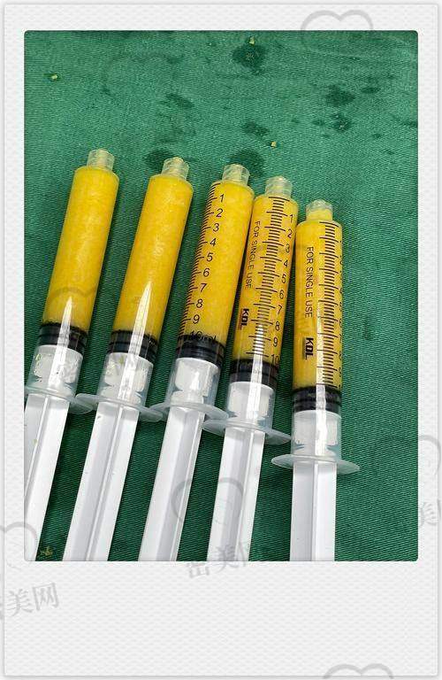 成都现代整形医院：医学背景强，服务专精靠谱