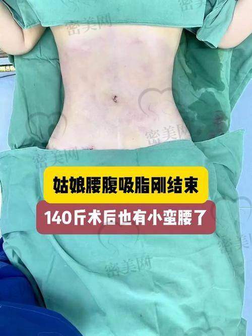 瘦出马甲线：快乐到飞起