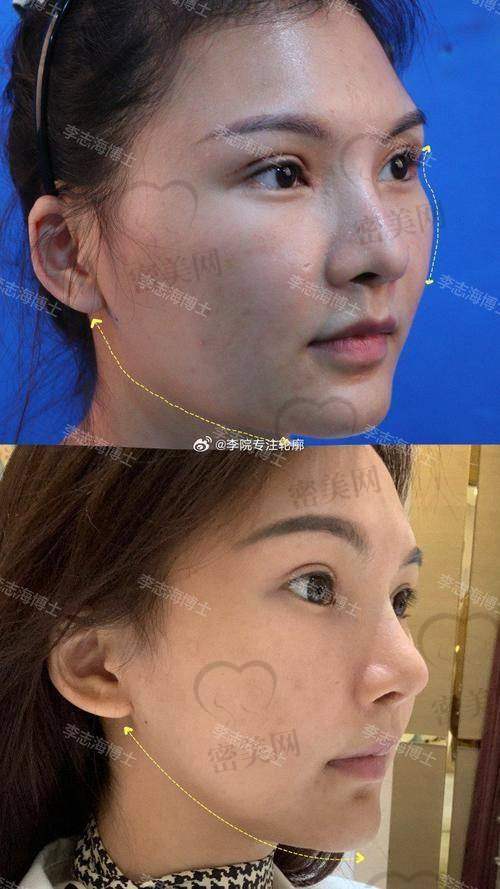 上海李志海医生口碑怎么样？技术优势大揭秘