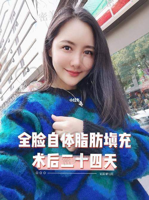 总结一下，脸部凹陷填充多少钱？