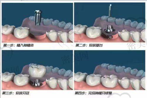 兰溪华博仕口腔门诊部的价格真的亲民吗？