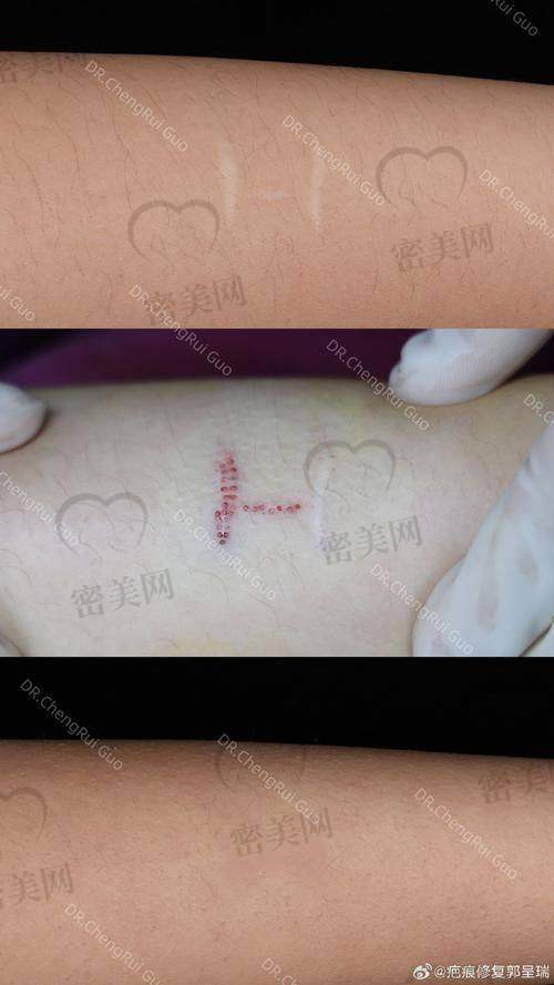 张家界慈利县人民医院皮肤科