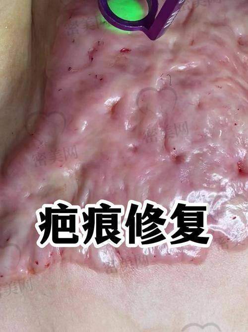 楚雄天使整形美容医院