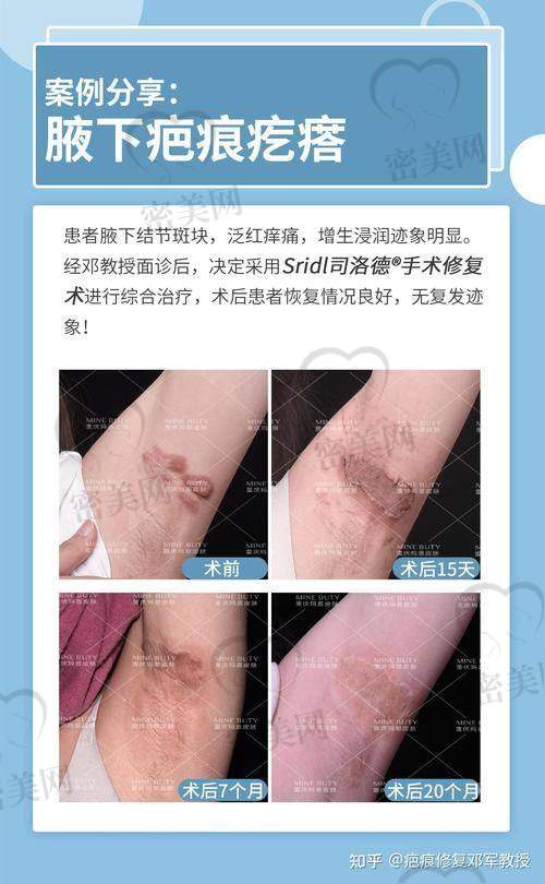 楚雄医 科 大学附属医院整形美容科