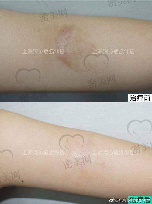 楚雄美莱美容医院
