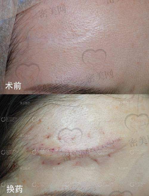 楚雄时光整形美容医院
