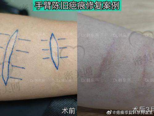 张家界永定区妇幼保健院皮肤科