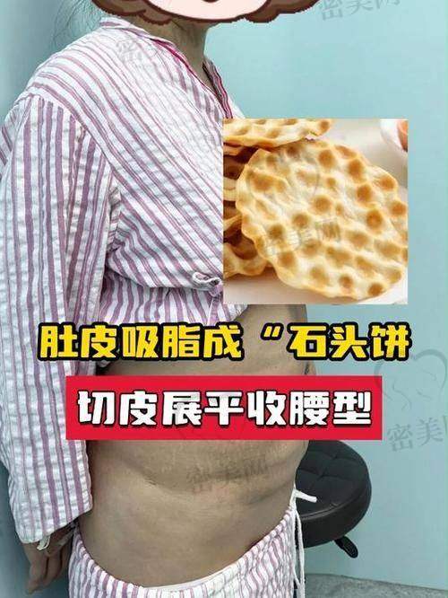 修复过程：紧张又期待