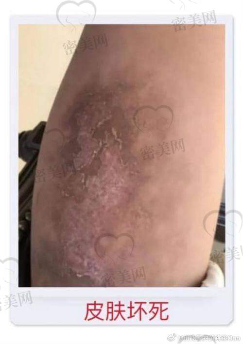 北京艺美硕德：靠谱的选择