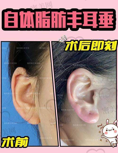 北京米兰柏羽丽都整形医院郭志华耳再造：优势特色大放送