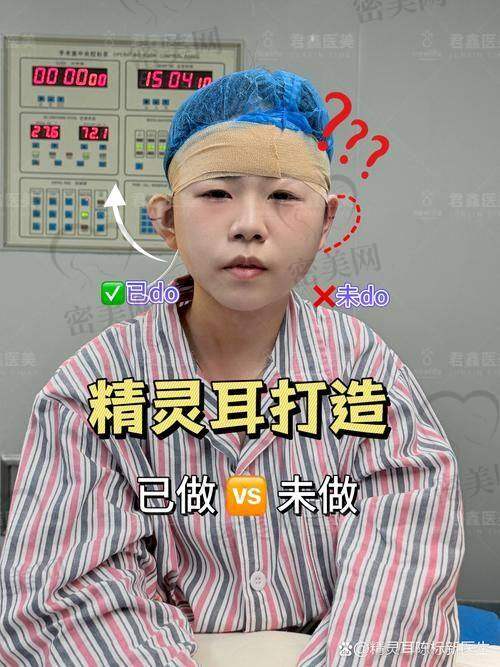 北京华韩：耳基底精细化注射的理想之选！