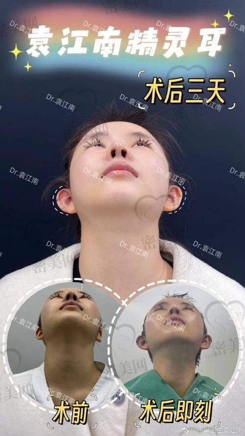 揭秘虞守辉：北京华韩的整形宝藏医生！