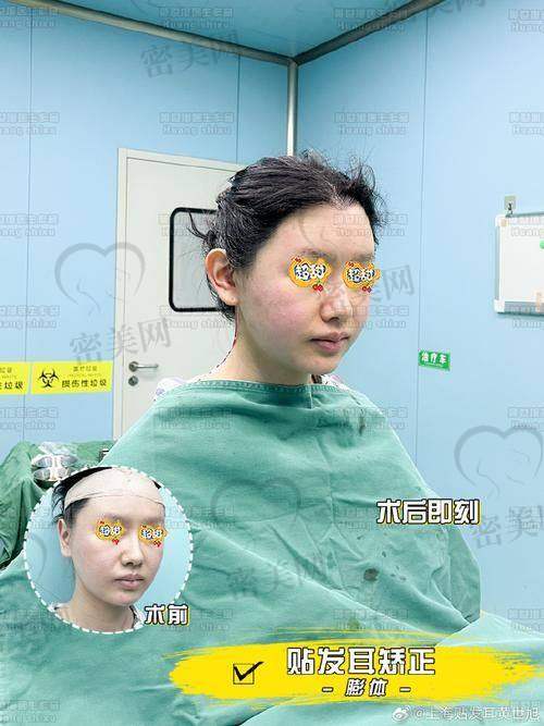 口碑爆棚！北京华韩虞守辉耳基底注射超受欢迎！