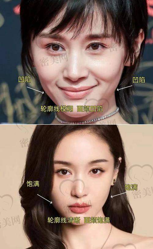 揭秘北京华韩整形医院虞守辉医生的变得更美魔法