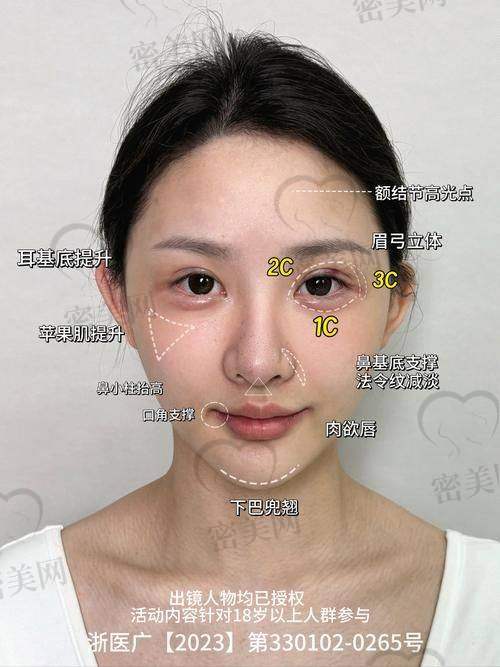 北京华韩整形医院虞守辉高定幼态脸全轮廓的真人实例