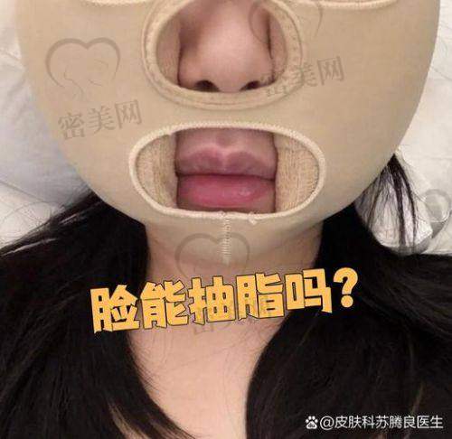 变得更美之后，自信满满
