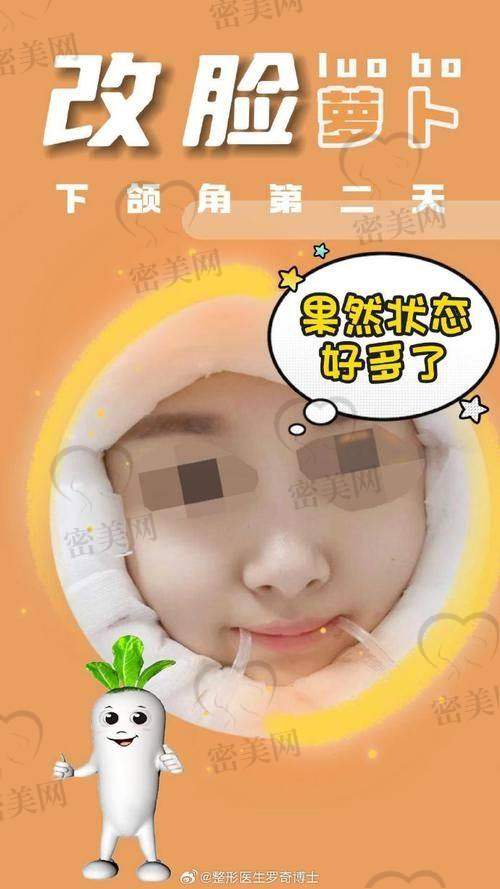 李志海磨骨实例：是惊艳还是翻车？