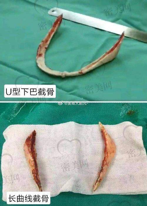 上海华美李志海收费标准大公开