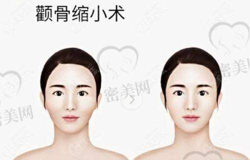 总结：变得更美路上的至佳选择