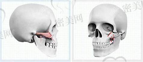 手术过程：紧张又期待的奇妙之旅