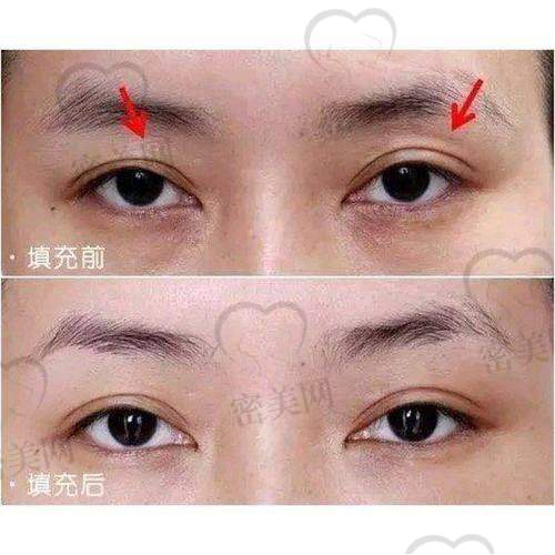 修复过程全知道